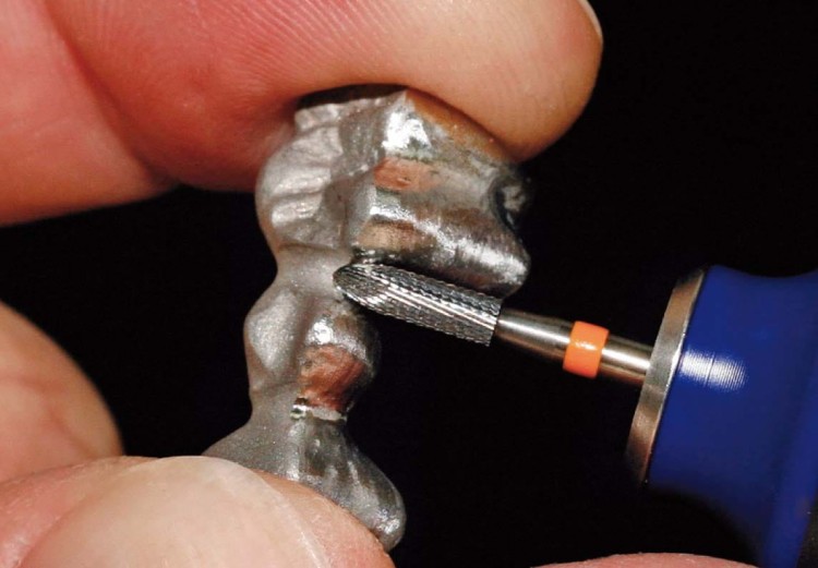 Frez protetyczny HF139NP-023 "torpeda" do metalu i akrylu (zdjęcie pracy).jpg