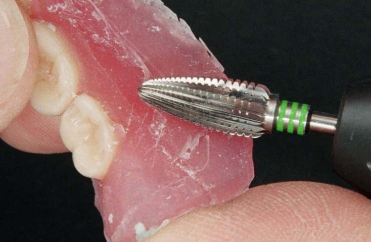 Frez protetyczny HFL251QSCN-060 "płomień" do nylonu i acetalu (zdjęcie pracy 2).jpg