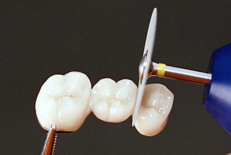 Separator diamentowy 355.504, nasyp obustronny na krawędzi (zdjęcie pracy).jpg