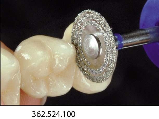 Mini separator diamentowy 362 TURBO, nasyp obustronny (zdjęcie pracy).jpg