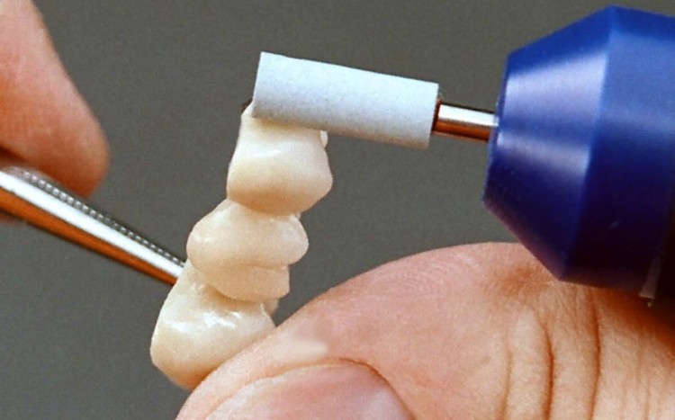 Kamień AllCeramic G8001 "walec" do cyrkonu i ceramiki (zdjęcie pracy).jpg