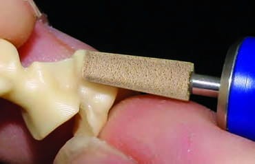 Kamień AllCeramic Hybrid G902 "ścięty stożek" do ceramiki (zdjęcie pracy).jpg