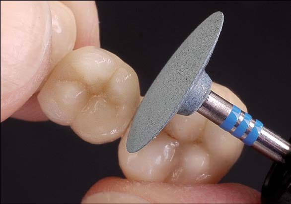 CeraGlaze P3042 do cyrkonu i ceramiki zdj. pracy.jpg