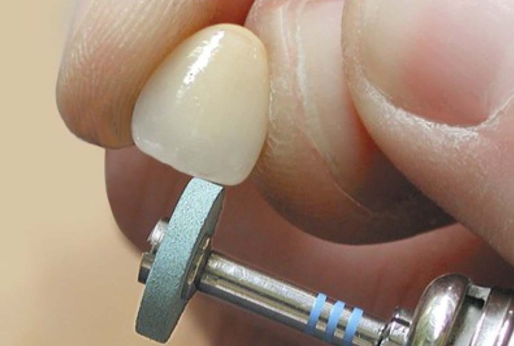 CeraGlaze P3043 zdj.pracy.jpg