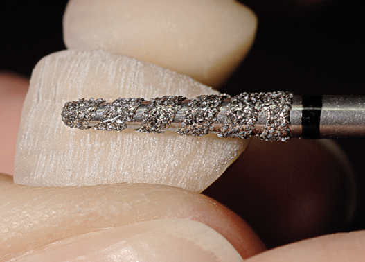 wiertło diamentowe turbo struktura anatomiczna zeba.png