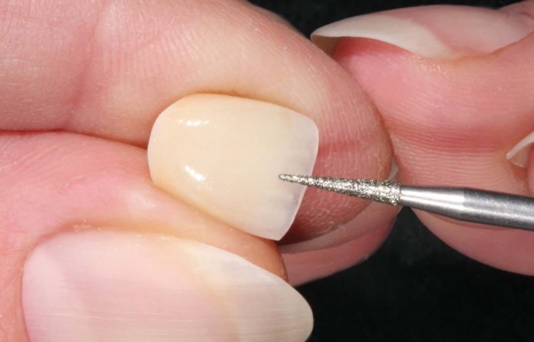 Frez diamentowy 856 TURBO zaokrąglony stożek na prostnicę (zdjęcie pracy).jpg