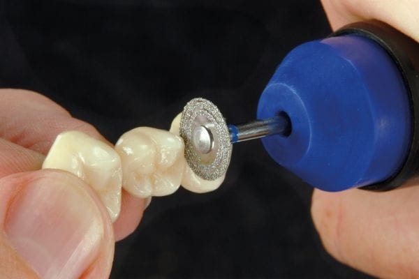 Mini separator diamentowy 362 TURBO, nasyp obustronny (zdjęcie pracy 2).jpg