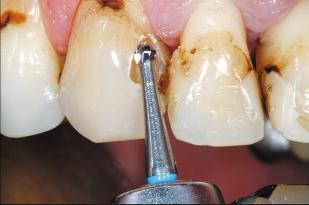 Wiertło różyczka H1SX-RAL (niebieski pasek) długi trzonek z węglika spiekanego (zdjęcie pracy).jpg