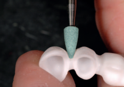 Kamień AllCeramic G8005 płomyk do cyrkonu i ceramiki (zdjęcie pracy).png