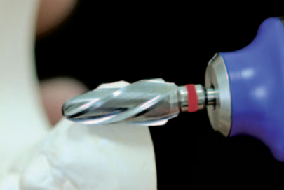 Frez protetyczny HF251SXCN-060 płomień do modeli gipsowych (zdjęcie pracy).png