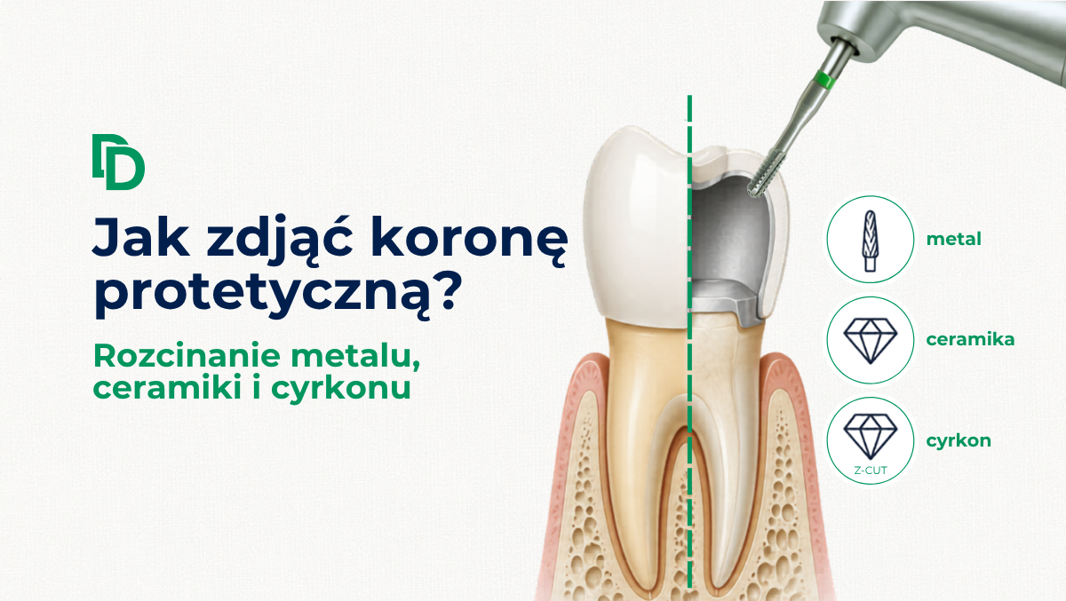 Jak zdjąć koronę protetyczną? Rozcinanie koron metalowych, ceramicznych i cyrkonowych